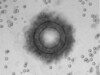 Plasma Filter Plasma Filter